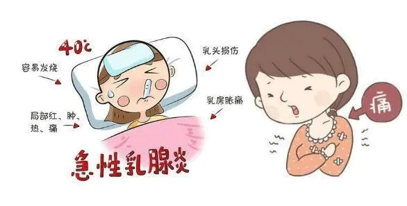 如何防治急性乳腺炎？