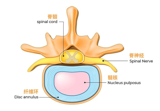 有些人腰痛，并不是因?yàn)槟I不好