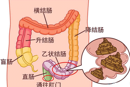 長(zhǎng)期便秘的十大危害