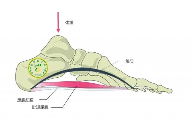 無(wú)創(chuàng)傷，無(wú)輻射，體外沖擊波康復(fù)治療為足跟痛患者帶來(lái)康復(fù)新希望!