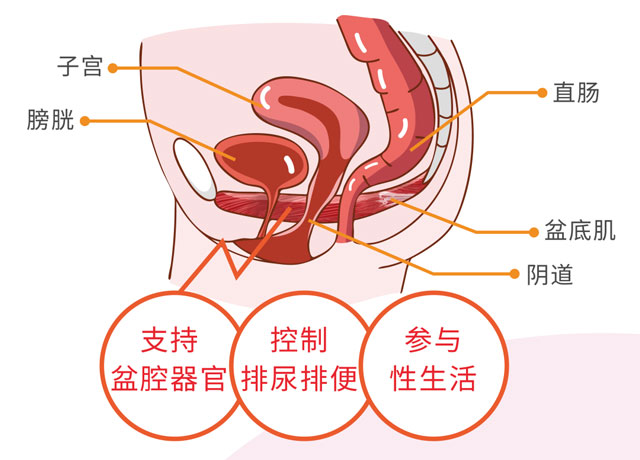 女性漏尿，趕緊查查盆底功能是否出了問題！