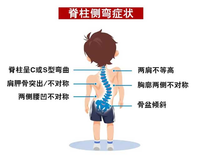 5.21脊柱健康日，家長要嚴防孩子脊柱側(cè)彎的發(fā)生！